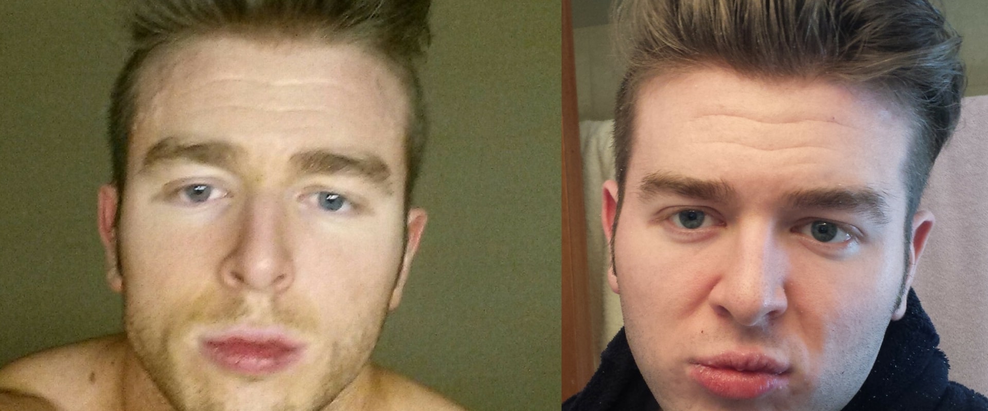 How Weight Loss Can Transform Your Face