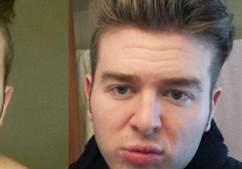 How Weight Loss Can Transform Your Face